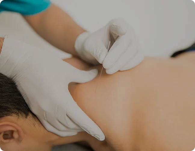 Dry Needling & Soft Tissue Optimization